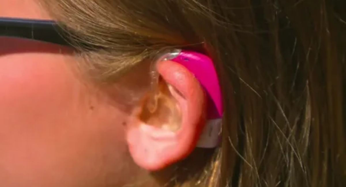 Why regular follow-ups are important after hearing aid fitting